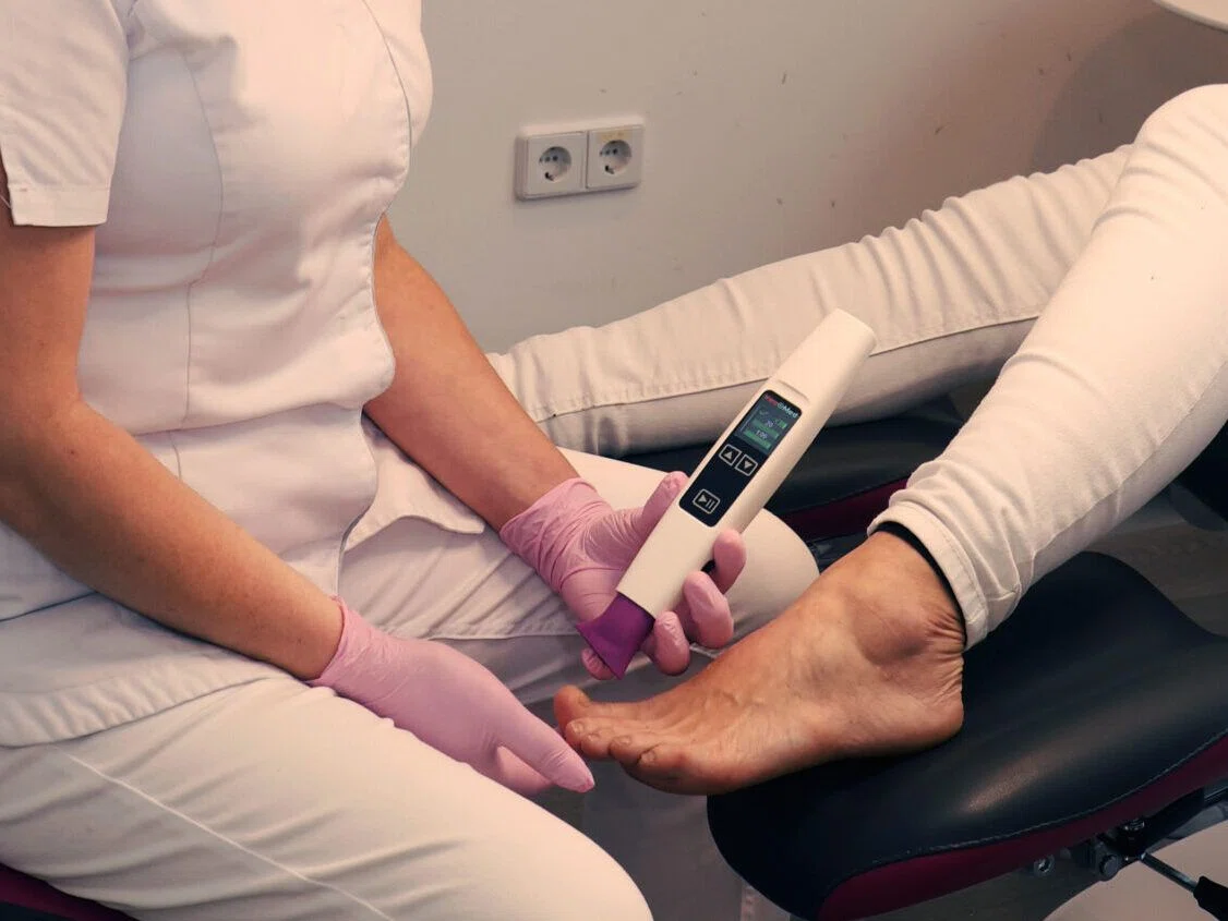 Kalt-Plasma-Behandlung bei Podotrend Berlin